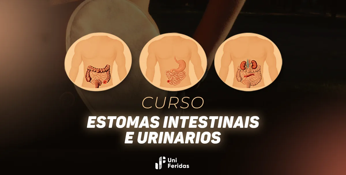 Capa do curso de estomas, com três ilustrações anatômicas de abdômen