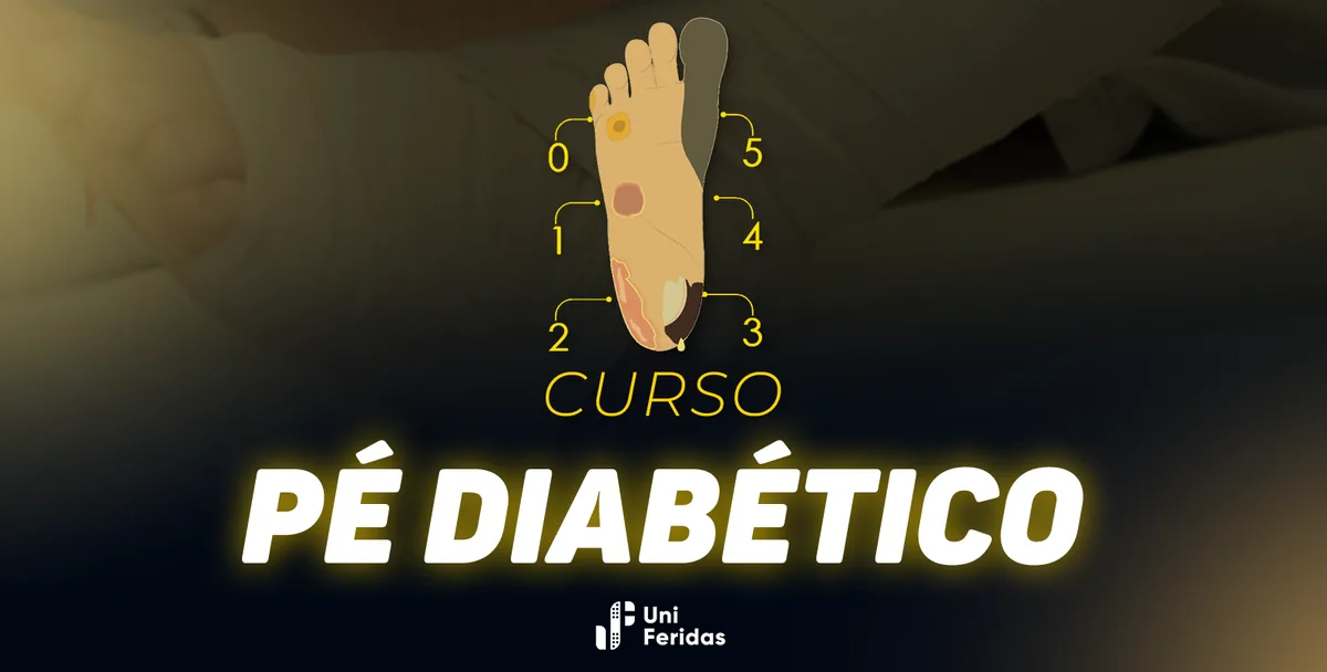 Capa do curso de pé diabético, com ilustração dos graus de lesão numerados de zero a cinco
